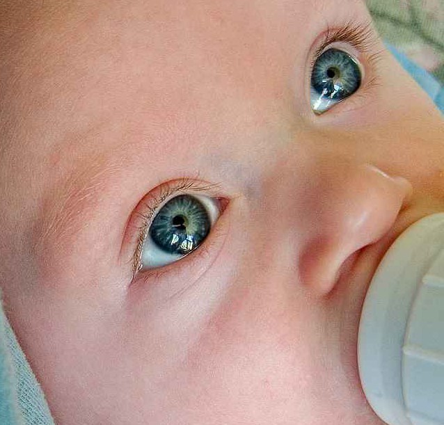 глаза  здорвого  ребёнка